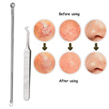 3pcs Silver Blackhead Comedone Extractor Acne Tool Blemish Extractor Pimple Remover Cosmetic Tool Stainless Acne Needles Remove