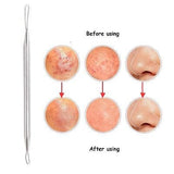 3pcs Silver Blackhead Comedone Extractor Acne Tool Blemish Extractor Pimple Remover Cosmetic Tool Stainless Acne Needles Remove