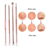 4Pcs Antibacterial Black Head Pimples Acne Needle Face Care Comedone Acne Blemish Extractor Remover Skin Face Cleansing Tool