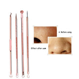 5PCS Blackhead Pimples Acne Needle Face Skin Care Tool Black Head Extractor Comedone Blemish Extractor Remover Cleanser Kit Tool