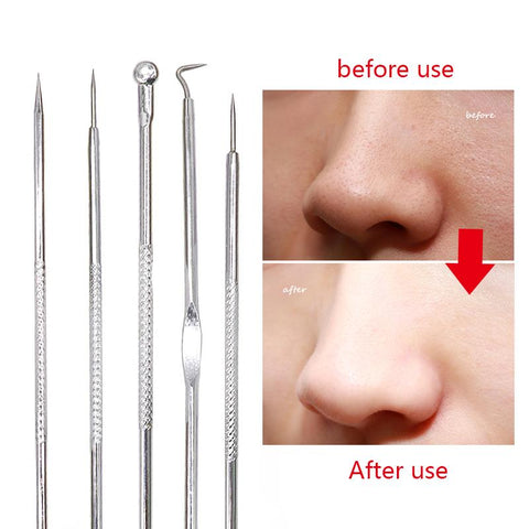 5PCS Blackhead Pimples Acne Needle Face Skin Care Tool Black Head Extractor Comedone Blemish Extractor Remover Cleanser Kit Tool