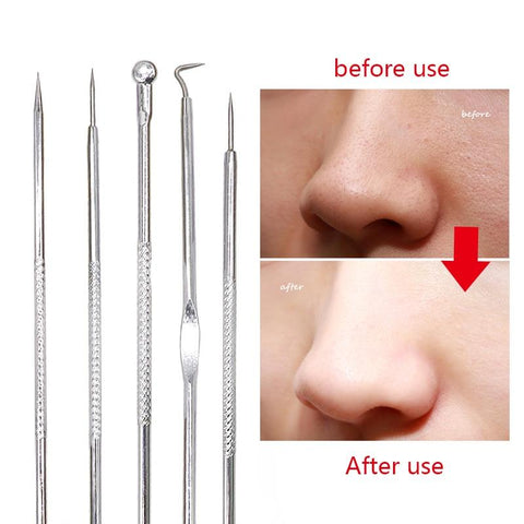 5Pcs Pimple Extractor Remover Kit Tool Face Skin Care Stainless Steel Needle Comedone Blackhead Remover Black Head Blemish Acne