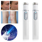 Blue Light Laser Pen Scar Acne Removal Anti Wrinkle Aging Therapy Acne Treatment Pen Beauty Device Facial Beauty Machine