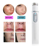 Drop Ship NEW 1PC Medical Blue Light Laser Therapy Acne Treatment Pen Anti Wrinkle Pores Removal Device Massage Relax Skin Care