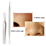 EFERO Blackhead Comedone Pimple Acne Extractor Remover Tool Set Blackheads Pimples Remover Tool Spoon for Face Cleaning