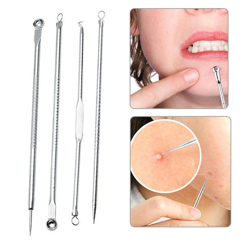 ELECOOL 4pcs Best Tool Set Stainless Face Care Acne Needle Tweezers Comedo Acne Facial Blackhead Spot Pimple Remover