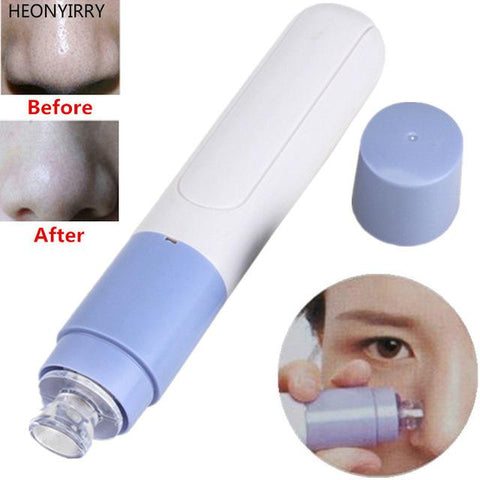 Electric Facial Pore Cleanser Acne Remover Point Noir Blackhead Vacuum Extractor Face Dirt  Cleaner Suck Up Pore Pimple Tools