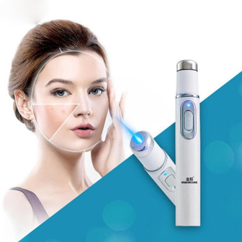 KD-7910 Acne Laser Pen Portable Wrinkle Removal Machine Durable Soft Scar Removal Device Blue Light Therapy Pen Skin care Beaty