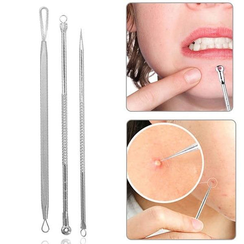 Putimi 4Pcs/Set Rose Gold Acne Blackhead Removal Needles Pimple Spot Comedone Extractor Cleanser Beauty Face Clean Care Tools