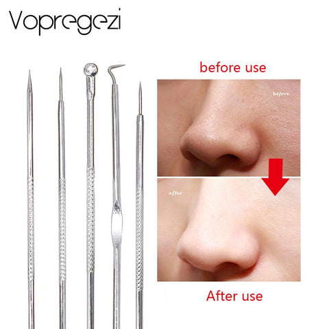 Vopregezi 5pcs/set Acne Blackhead Removal Needles Stainless Pimple Spot Comedone Acne Extractor Cleanser Black Head Remover Tool