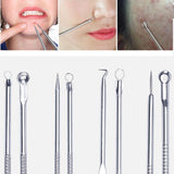 foreverlily Acne Blackhead Removal Needles Stainless Pimple Spot Comedone Extractor Cleanser Beauty Face Clean Care Tools